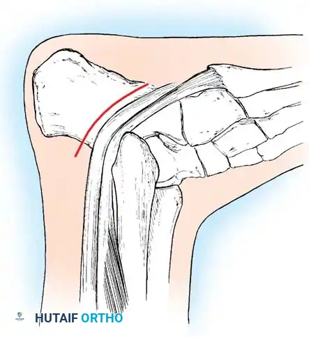 Hutaifortho's Orthopaedic Diagram