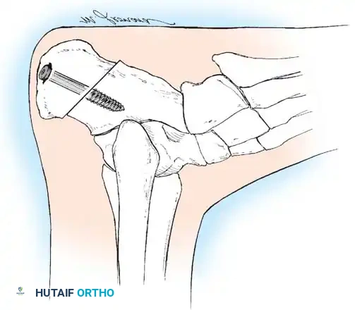 Hutaifortho's Orthopaedic Diagram