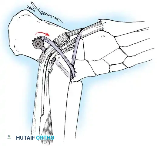 Hutaifortho's Orthopaedic Diagram