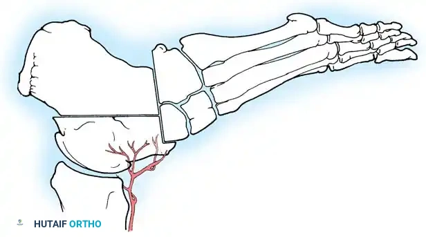 Hutaifortho's Orthopaedic Diagram