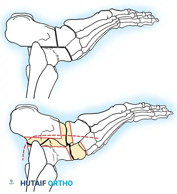 Hutaifortho's Orthopaedic Diagram