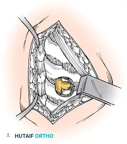 Hutaifortho's Orthopaedic Diagram