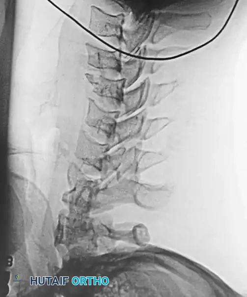 Hutaifortho's Orthopaedic Diagram