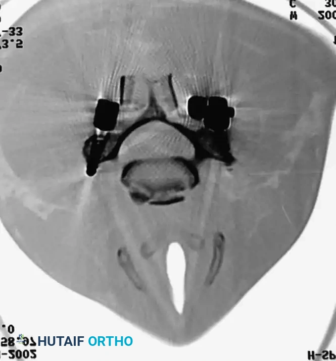 Hutaifortho's Orthopaedic Diagram