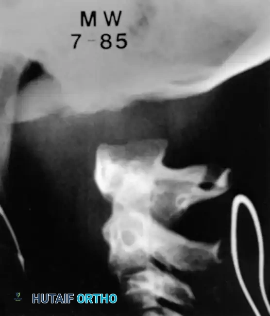 Hutaifortho's Orthopaedic Diagram