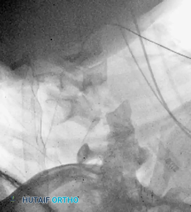 Hutaifortho's Orthopaedic Diagram