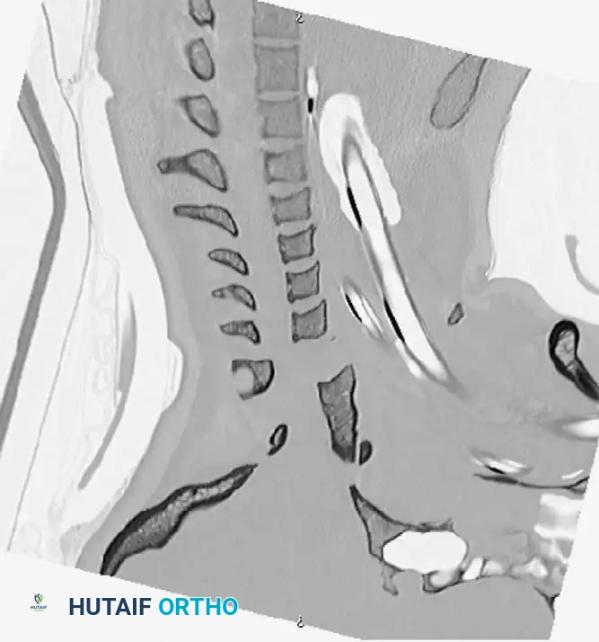 Hutaifortho's Orthopaedic Diagram