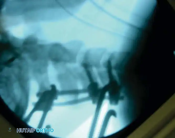 Hutaifortho's Orthopaedic Diagram