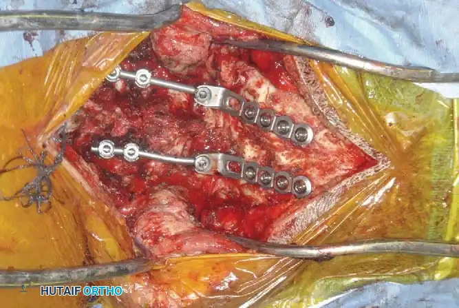 Hutaifortho's Orthopaedic Diagram