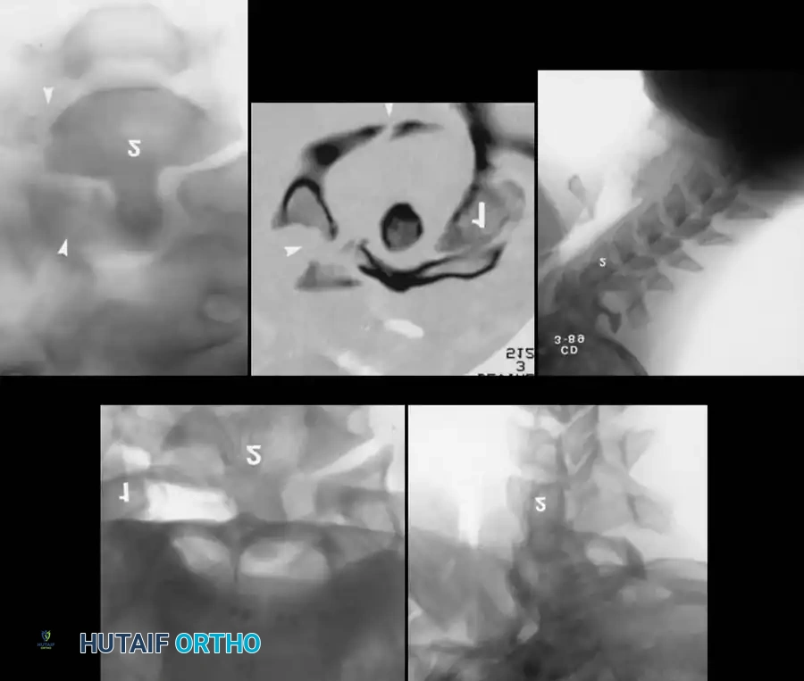 Hutaifortho's Orthopaedic Diagram