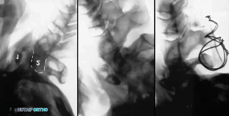 Hutaifortho's Orthopaedic Diagram