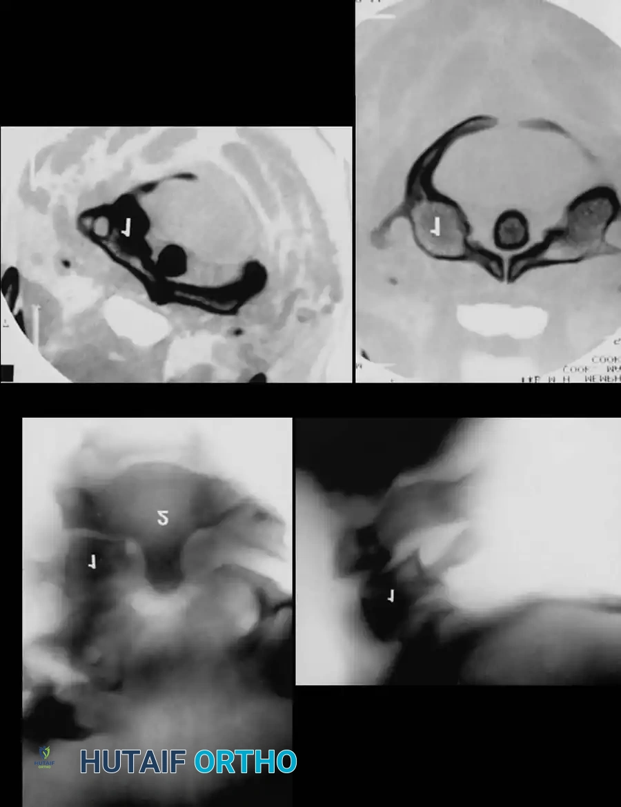 Hutaifortho's Orthopaedic Diagram