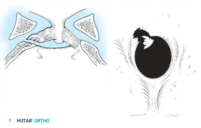 Hutaifortho's Orthopaedic Diagram