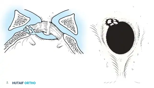 Hutaifortho's Orthopaedic Diagram