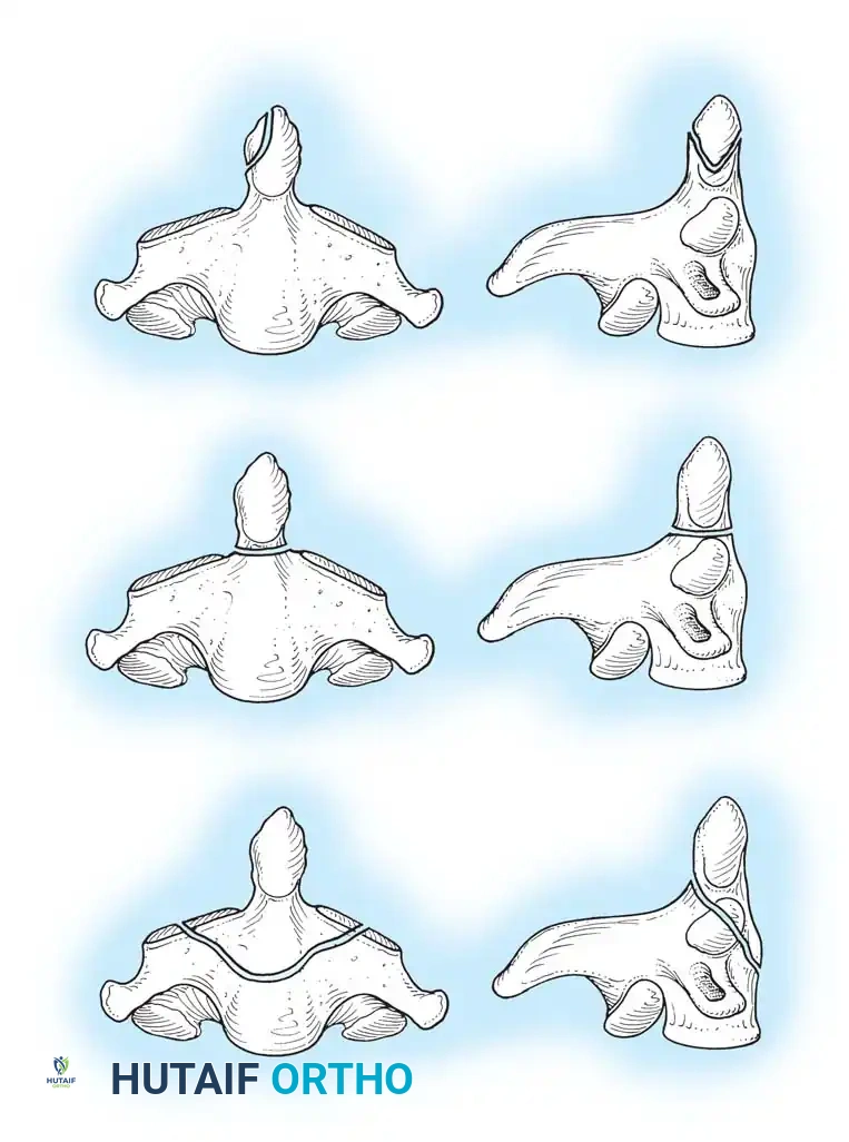 Hutaifortho's Orthopaedic Diagram