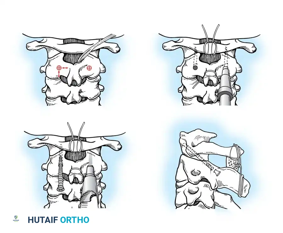 Hutaifortho's Orthopaedic Diagram