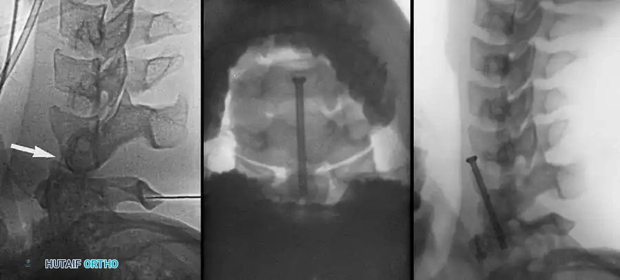 Hutaifortho's Orthopaedic Diagram
