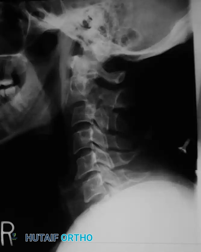 Hutaifortho's Orthopaedic Diagram