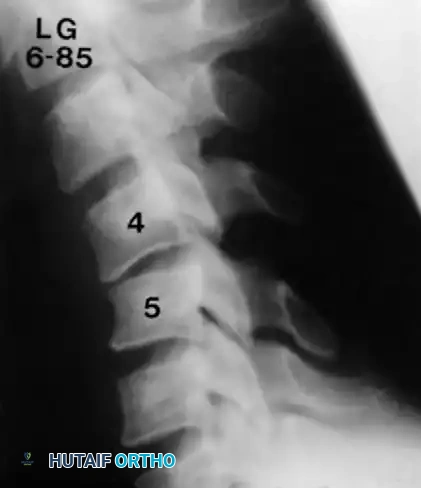Hutaifortho's Orthopaedic Diagram