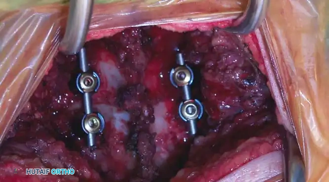 Hutaifortho's Orthopaedic Diagram
