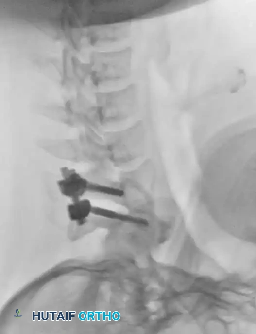 Hutaifortho's Orthopaedic Diagram