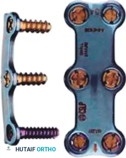 Hutaifortho's Orthopaedic Diagram