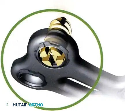 Hutaifortho's Orthopaedic Diagram