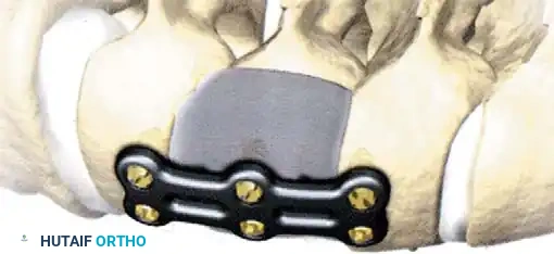 Hutaifortho's Orthopaedic Diagram