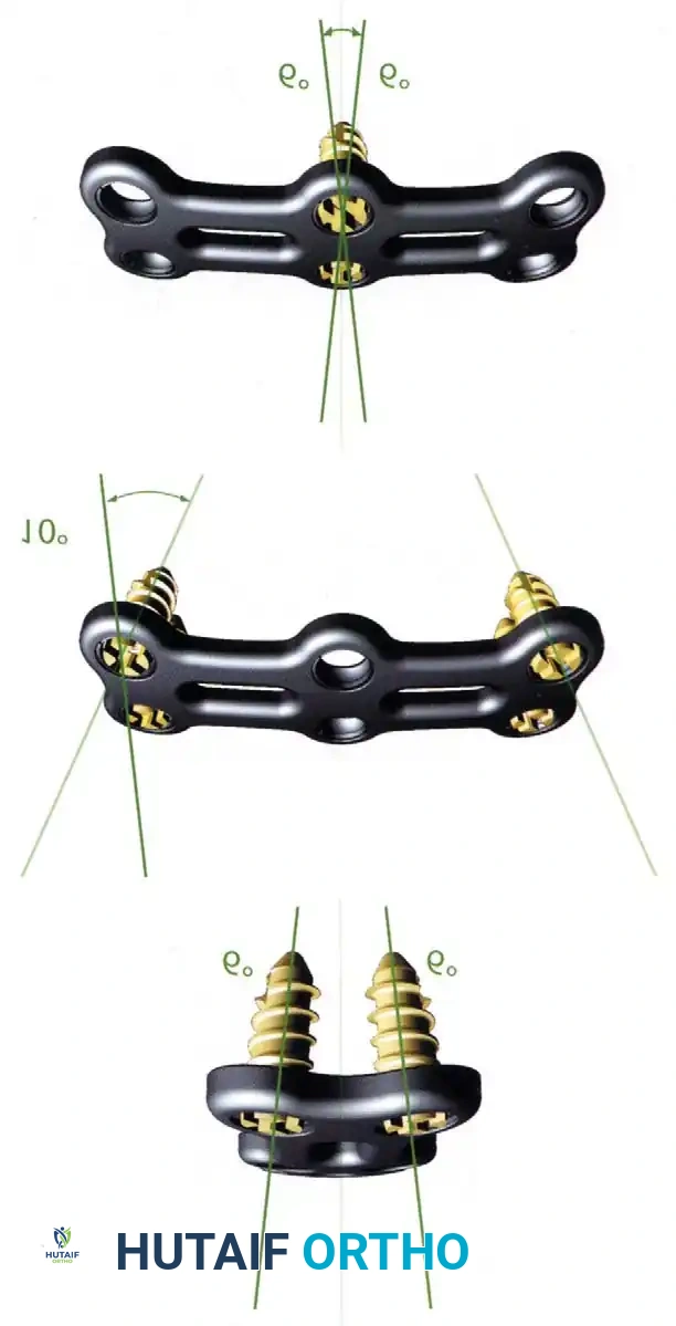 Hutaifortho's Orthopaedic Diagram