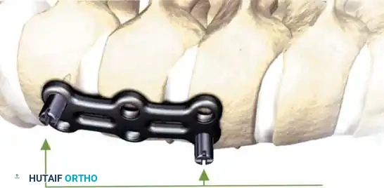 Hutaifortho's Orthopaedic Diagram