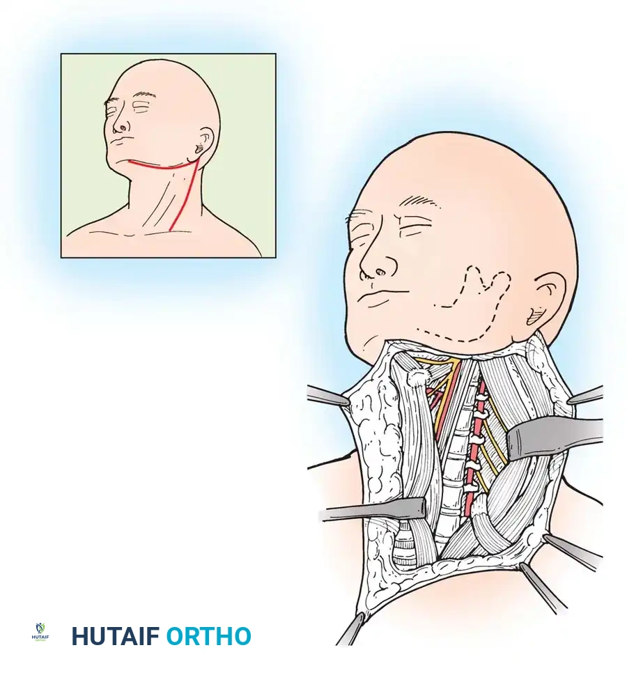 Mastering Anterior Cervical Arthrodesis: Operative Techniques and Evidence-Based Management
