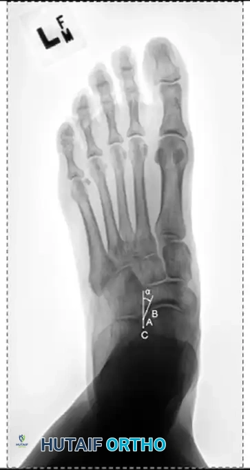 Hutaifortho's Orthopaedic Diagram