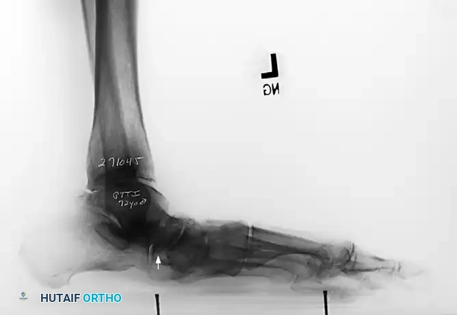 Hutaifortho's Orthopaedic Diagram