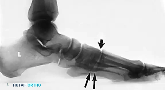 Hutaifortho's Orthopaedic Diagram