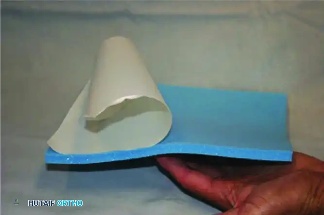 CHARCOT ARTHROPATHY Surgical Diagram