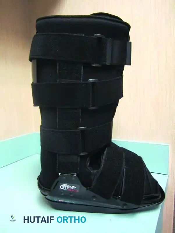 CHARCOT ARTHROPATHY Surgical Diagram