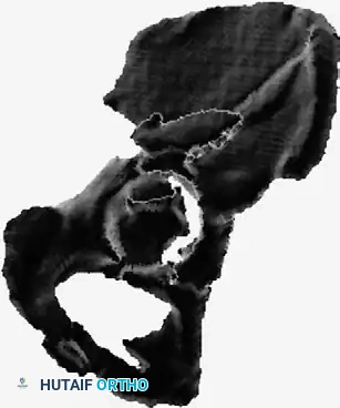 Hutaifortho's Orthopaedic Diagram