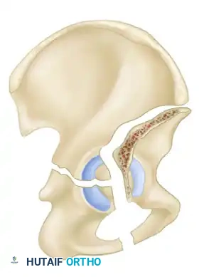 Hutaifortho's Orthopaedic Diagram