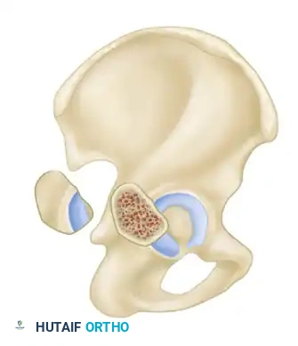 CLASSIFICATION Surgical Diagram