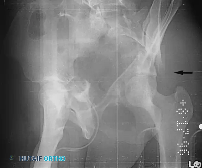 CLASSIFICATION Surgical Diagram