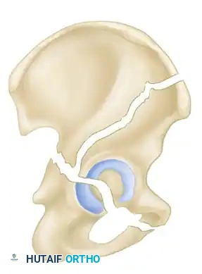 Hutaifortho's Orthopaedic Diagram