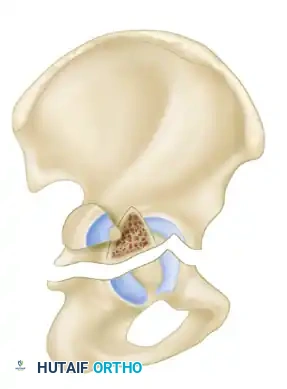 Hutaifortho's Orthopaedic Diagram