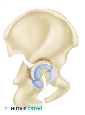 Hutaifortho's Orthopaedic Diagram