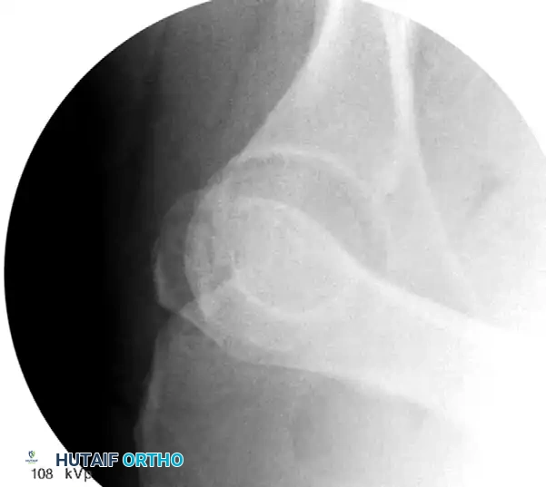Hutaifortho's Orthopaedic Diagram