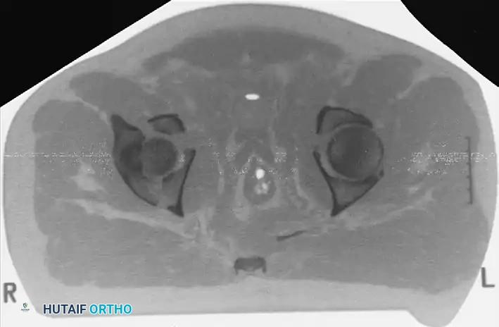 Hutaifortho's Orthopaedic Diagram
