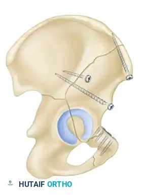 Hutaifortho's Orthopaedic Diagram