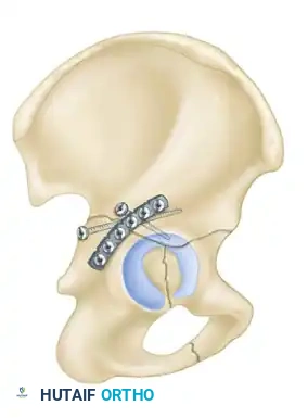Hutaifortho's Orthopaedic Diagram