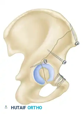 Hutaifortho's Orthopaedic Diagram