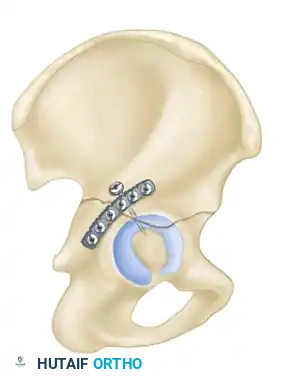 Hutaifortho's Orthopaedic Diagram