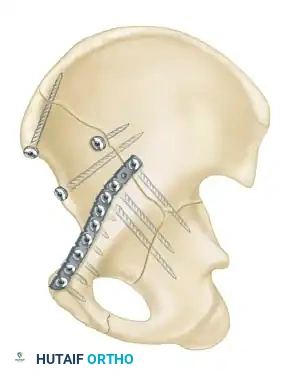 Hutaifortho's Orthopaedic Diagram